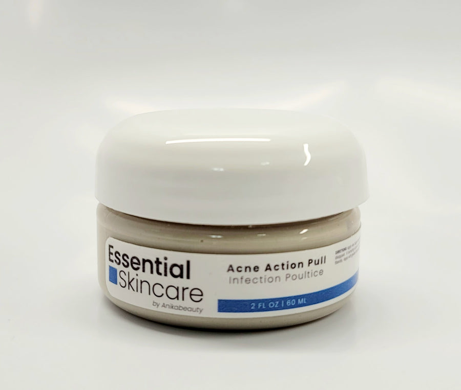 Facial Skincare Services - shop-anikabeauty-com - Acne Action Pull - Infection Poultice Essential Skincare by Anikabeauty Face.