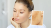 Best skincare ingredients for helping melasma. Anika skincare goes through helpful ingredients in this prat 2 blog.