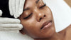 Microcurrent Facials with Complementary Treatments